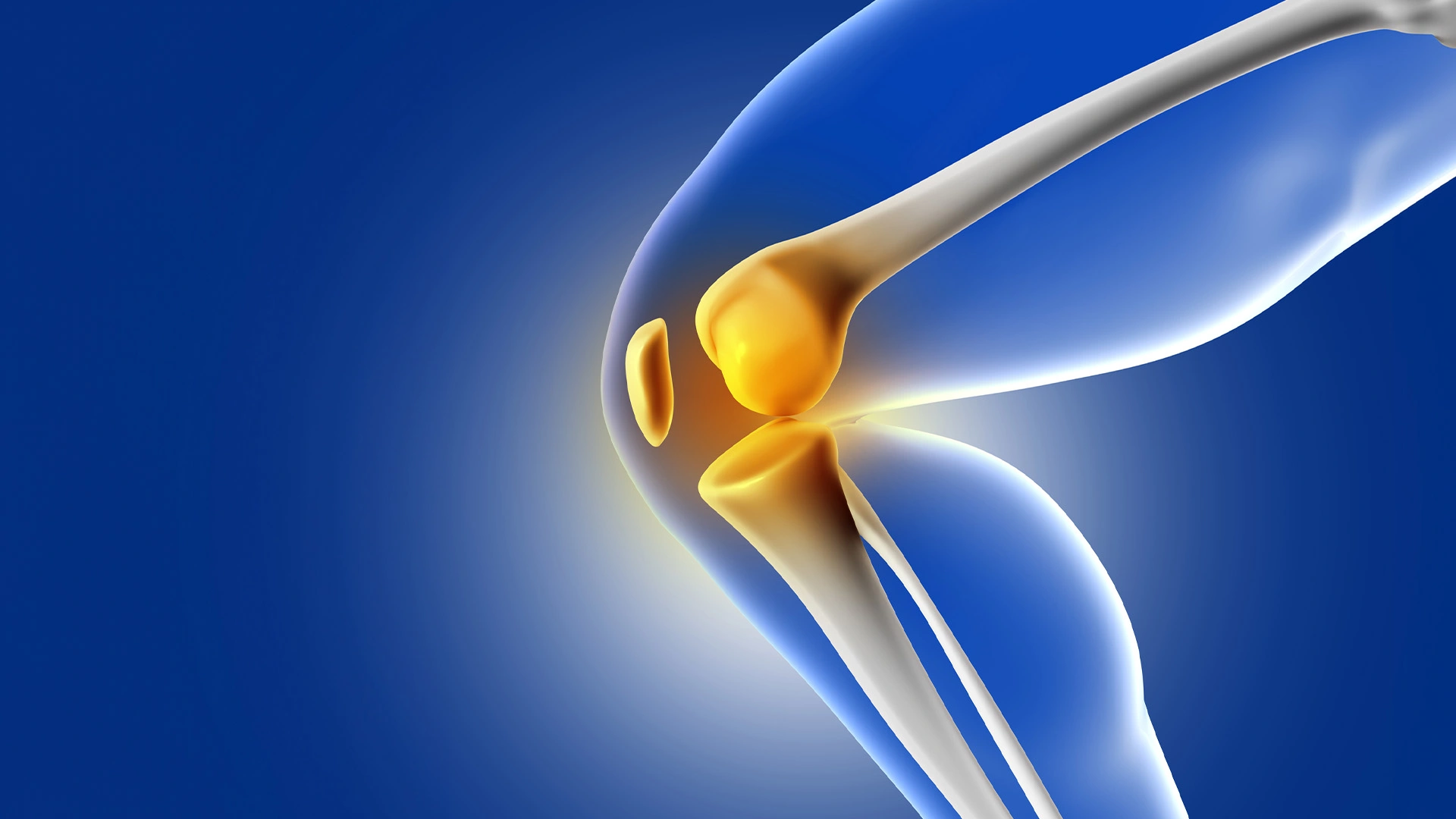 Ilustrasi kesehatan tulang.