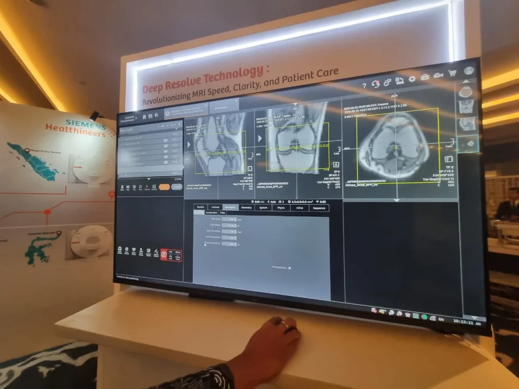 Siemens Healthineers meluncurkan layanan teknologi kesehatan MAGNETOM Flow