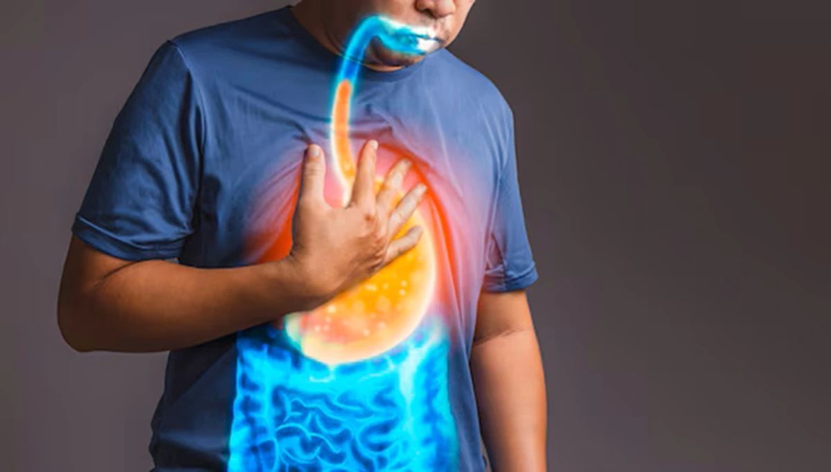 Ramai di Media Sosial, Istilah GERD Bisa Memengaruhi Jantung Dinilai Menyesatkan