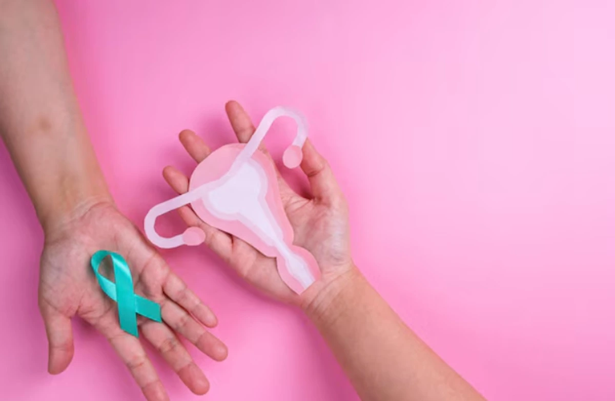 Ilustrasi kanker ovarium