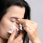 Tips mengatasi mimisan dengan menekan hidung secara pelan menggunakan tisu.(freepik)