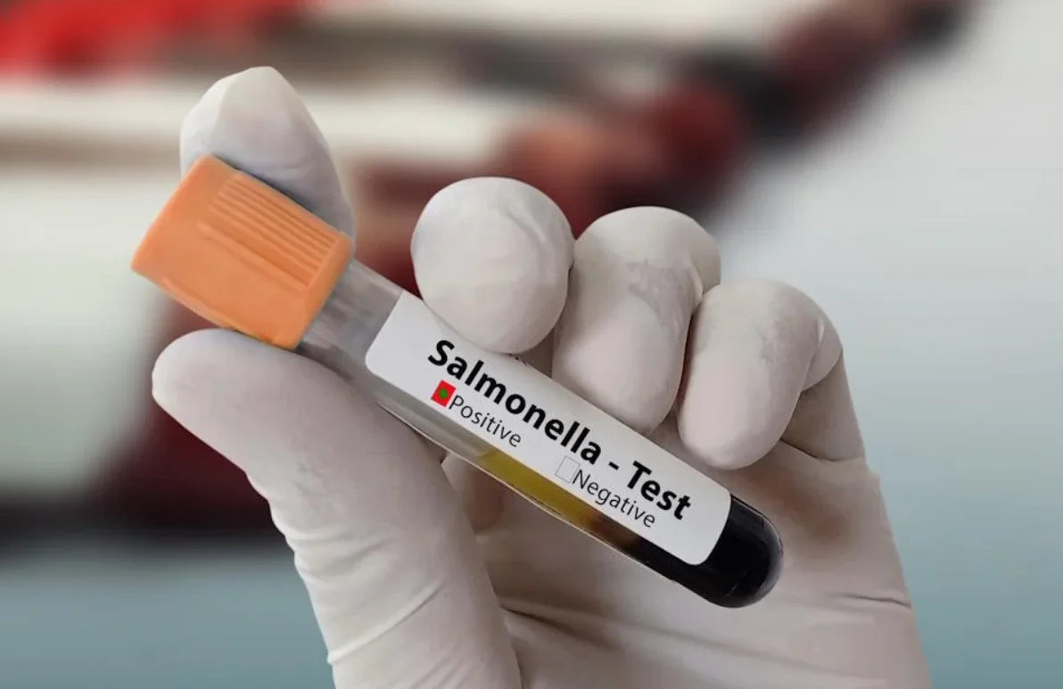Viral Bayi Diduga Meninggal usai Diberi Telur Mentah, IDAI Ingatkan Bahaya Salmonella